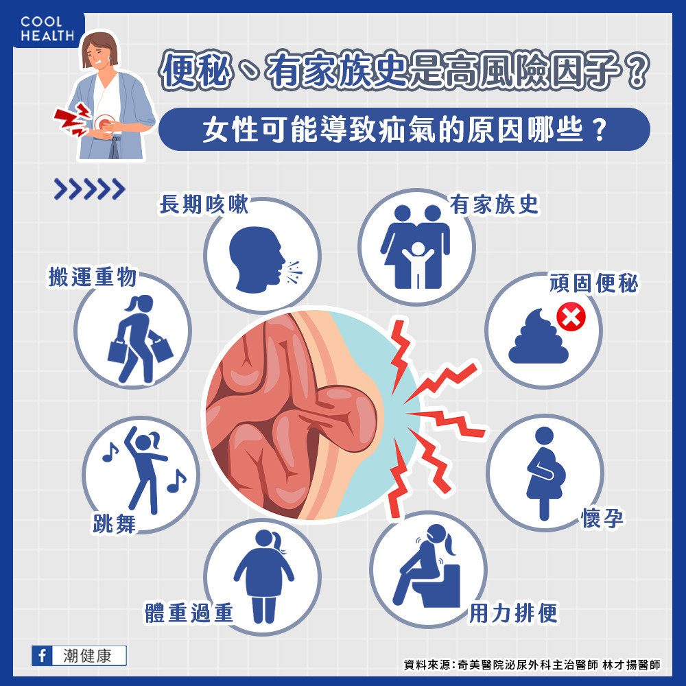 女性也可能出現疝氣問題？ 便秘、愛跳舞都可能是風險因子？