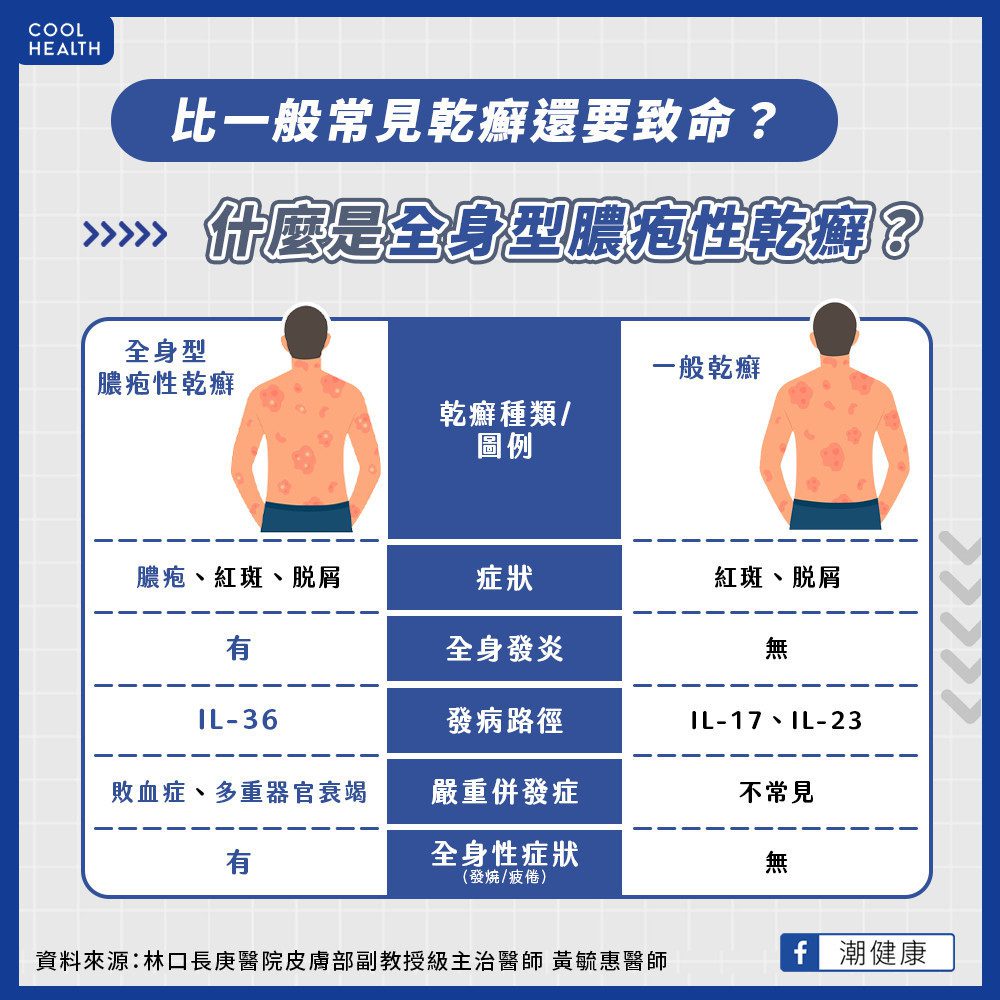 皮膚重症GPP恐伴致命併發症 台病友每10人有3人延遲半年診斷